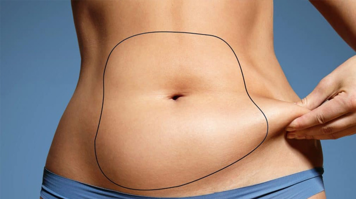 liposuction treatment in Ludhiana